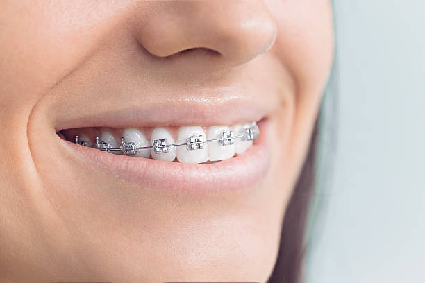 Best Veneers and Lumineers  in West Rancho Dominguez, CA